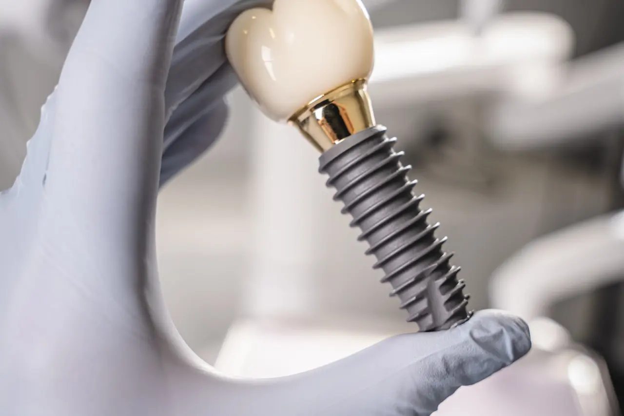 Mână cu mănușă ținând un implant dentar cu coroană