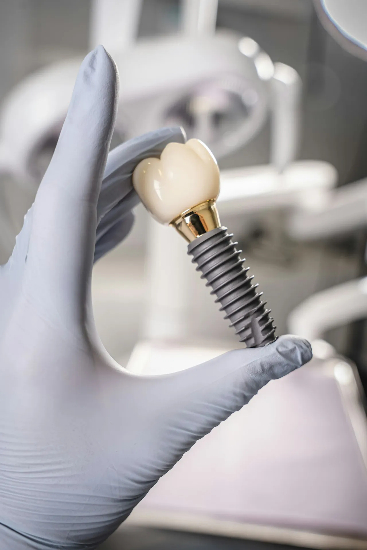 Implant dentar cu coroană, ținut în mână de medic